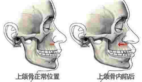 陈冠希和谢霆锋（为什么40岁的谢霆锋像30岁）(图17)