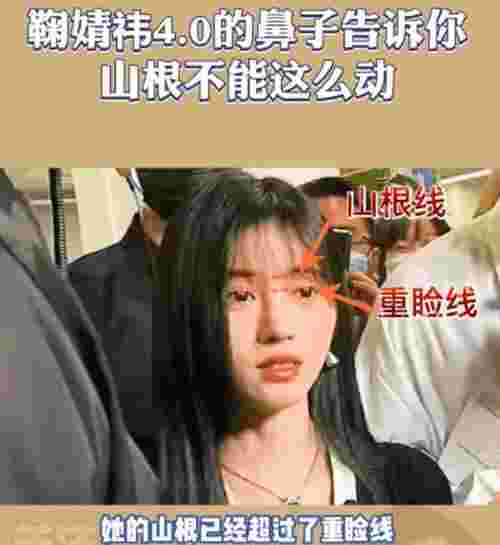 鞠婧祎鼻子，看脸博主直言鞠婧祎的鼻子又整了但很失败(图18)