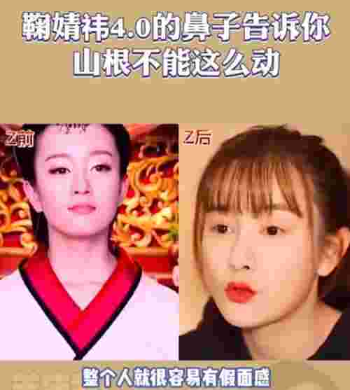 鞠婧祎鼻子，看脸博主直言鞠婧祎的鼻子又整了但很失败(图20)