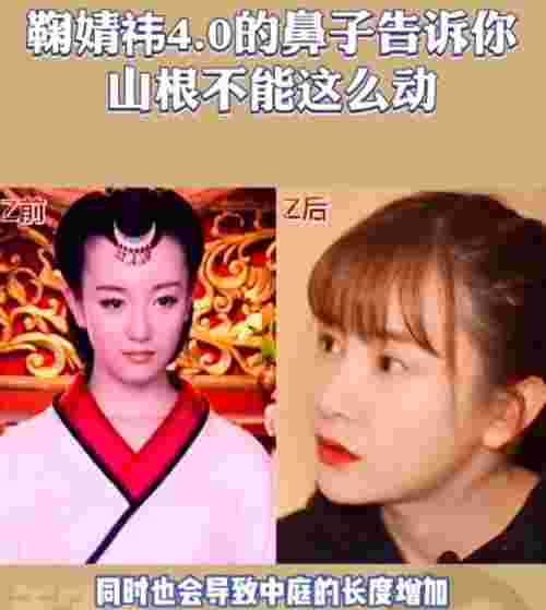 鞠婧祎鼻子，看脸博主直言鞠婧祎的鼻子又整了但很失败(图19)